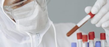Germany coronavirus testing capacity
